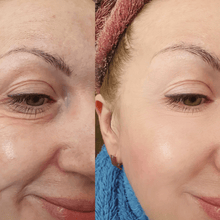 Load image into Gallery viewer, NoCrowZ Retinol Eye Cream