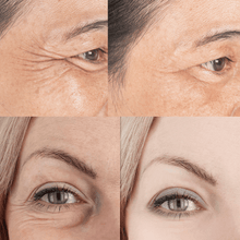 Load image into Gallery viewer, NoCrowZ Retinol Eye Cream