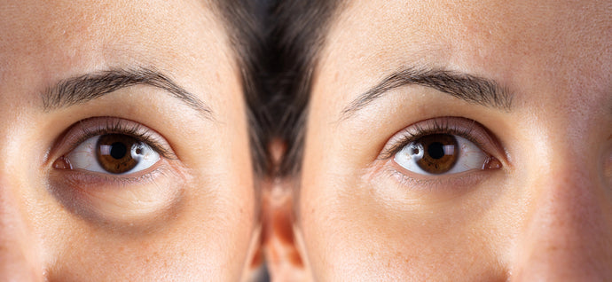 How to Tighten and Firm the Skin Around Your Eyes